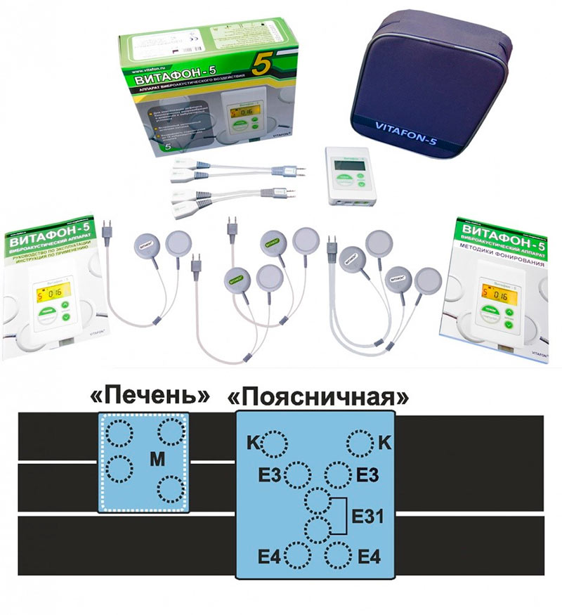 V 5 rasshirennaya korset